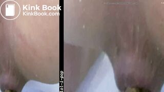 Amazing Distended Assholes - video 3