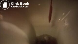 a bit of diarrhea