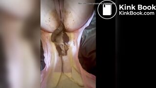 Girl Messing Her Diaper During Change