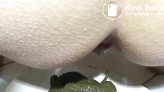 Green poo..