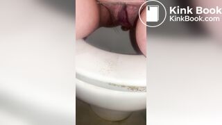 Managed to get a bit of constipated poos out