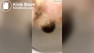 Constipated - laxatives helped a little