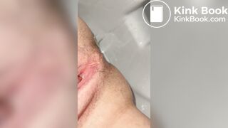 Urgent shit - video 39