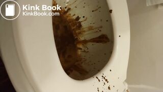 Girls bad meth sex rea