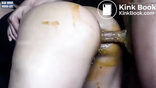 Cum on shitty ass