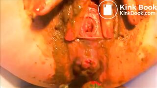 Poopy prolapse..