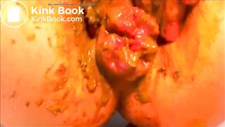 Poopy prolapse..