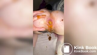 Huge shit