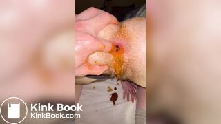 Huge shit