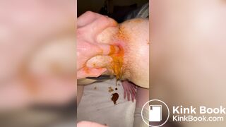 Huge shit