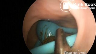 girls dirty vibrator removed