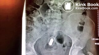 girls dirty vibrator removed