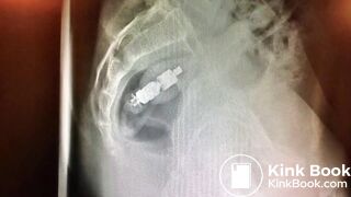 girls dirty vibrator removed