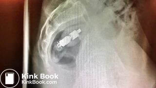 girls dirty vibrator removed