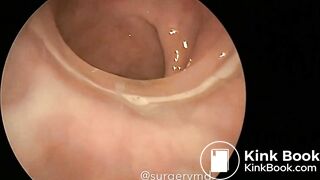 girls dirty vibrator removed