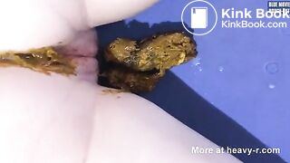 Nutting on hard turd