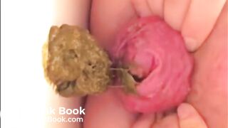 Milf prolapsed her anus and shits