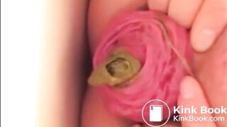 Milf prolapsed her anus and shits