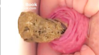 Milf prolapsed her anus and shits