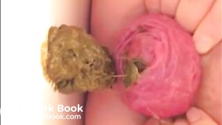 Milf prolapsed her anus and shits