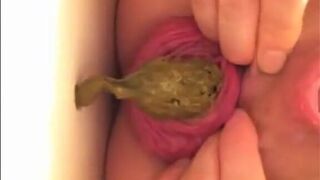 prolapsed japanese open wide