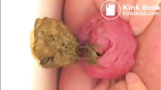 prolapsed japanese open wide