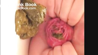 prolapsed japanese open wide