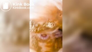 Cute teen does diarrhea in jeans