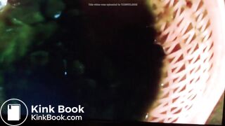 UK Celebrity Toilet ... - Colon Cleanse Detox