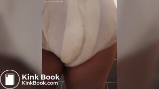 Diaper poop in wet diaper