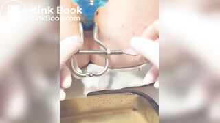 Urine sample at gyno p. 2/2B