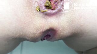 A lot of corns in her diet.