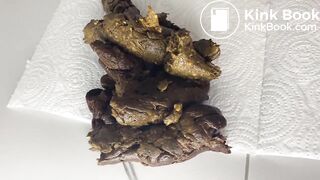 A lot of corns in her diet.