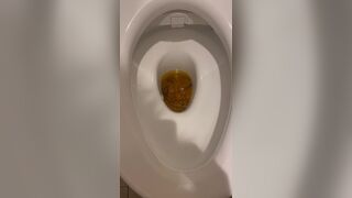 DIARRHEA POOP