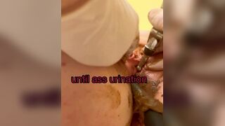 Urethra scat until anal urination