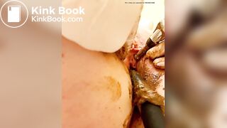 Urethra scat until anal urination