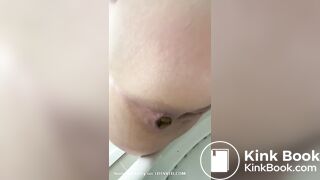 Closeup shit and piss