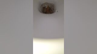 Runny urgent poop