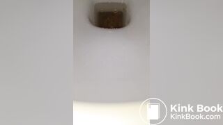 Runny urgent poop