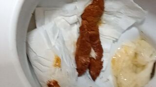 splacnuti me velke klady