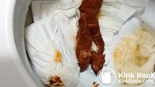 splacnuti me velke klady