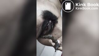 Pooping Out Of Pussy