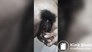 Pooping Out Of Pussy