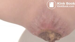 scat 02