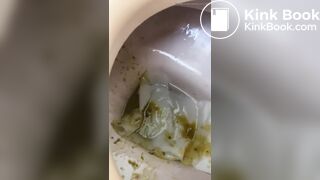 Japanese girl with diarrhea - video 5