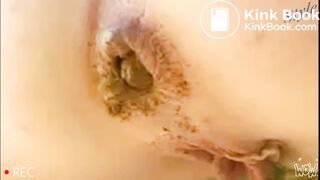 She Have Very Annoyed Turds