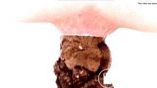 Japanese toilet voyeur young girl shitting close up 1