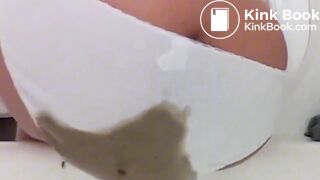 Explosive diarrhea blowout