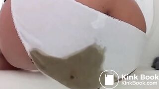 Explosive diarrhea blowout