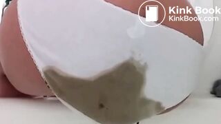 Explosive diarrhea blowout